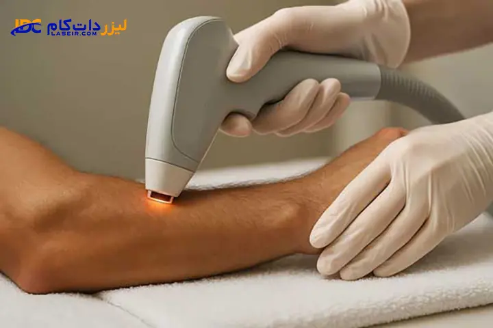 دلایل روشن نشدن لیزر موهای زائد