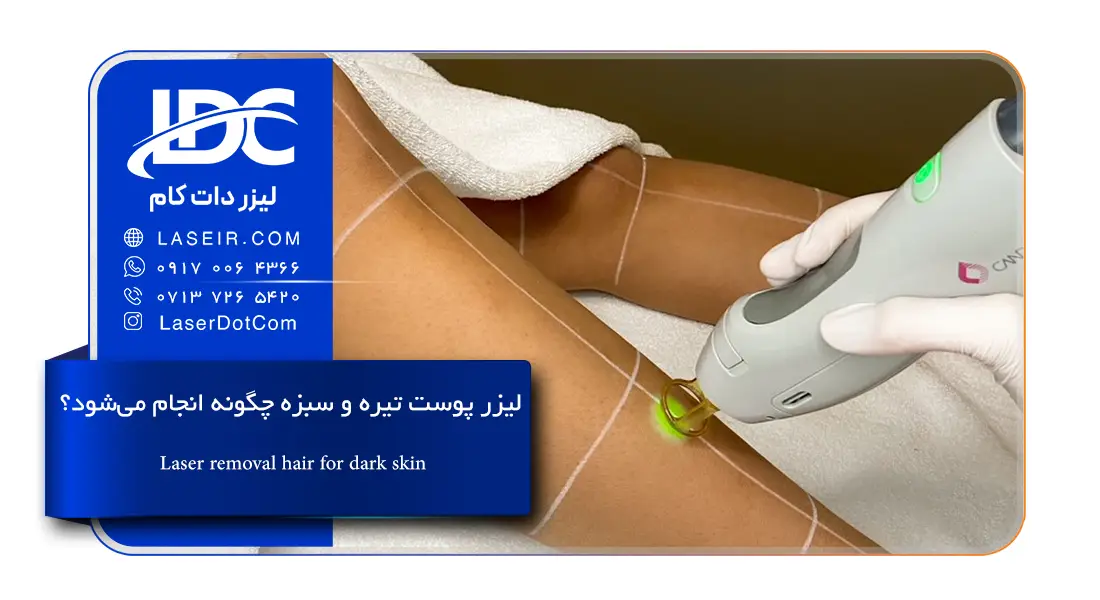 دستگاه لیزر پوست تیره