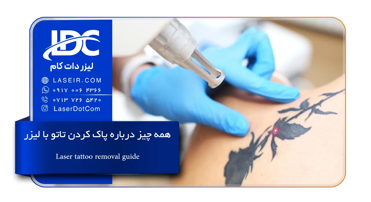پاک کردن تاتو با لیزر