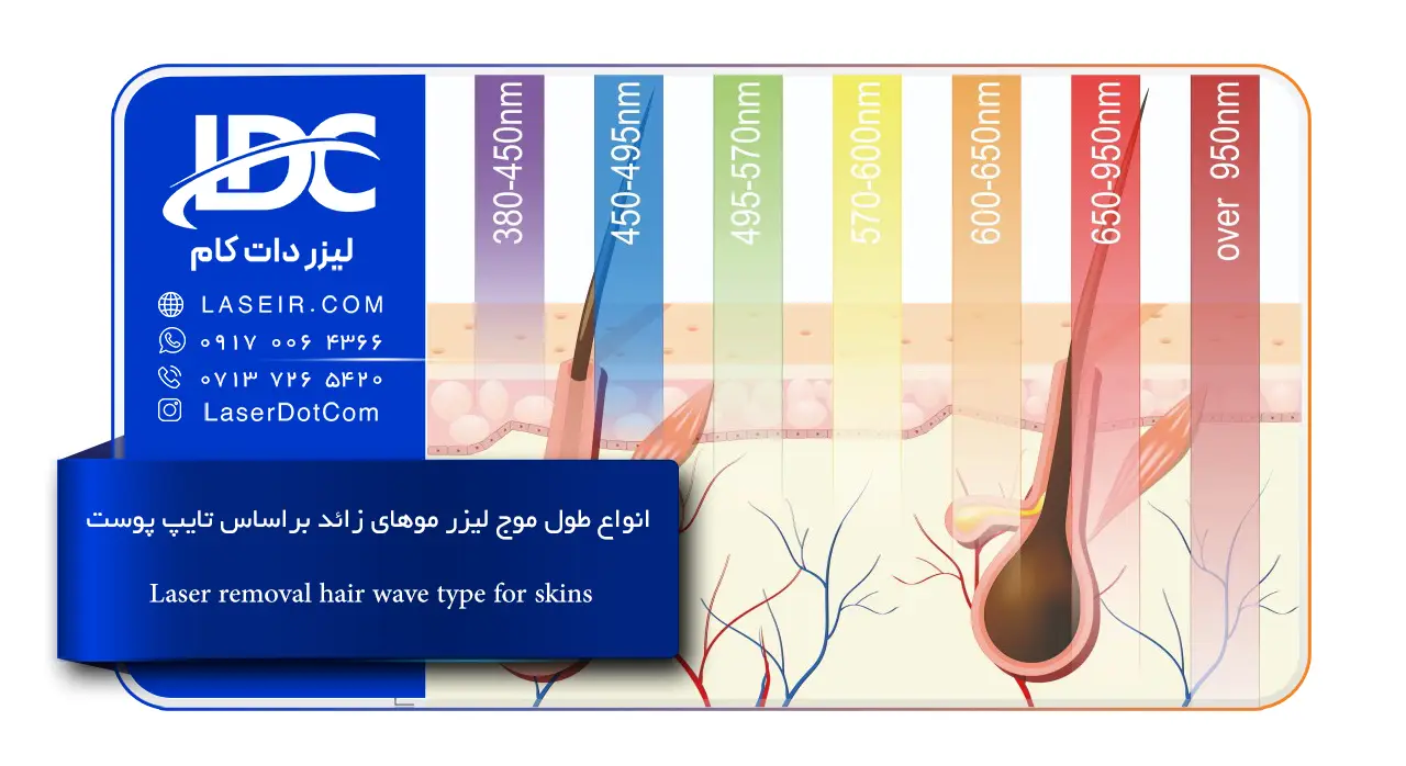 انواع طول موج لیزر موهای زائد