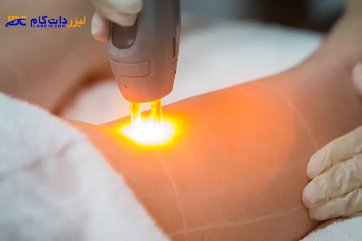 تکنیسین لیزر زیبایی