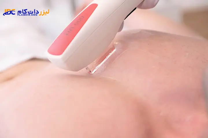 اپراتور لیزر موهای زائد