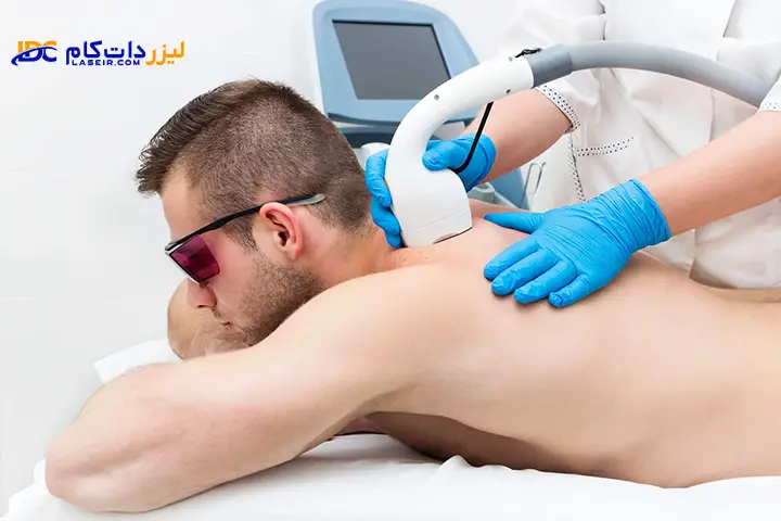 دستگاه لیزر موهای زائد