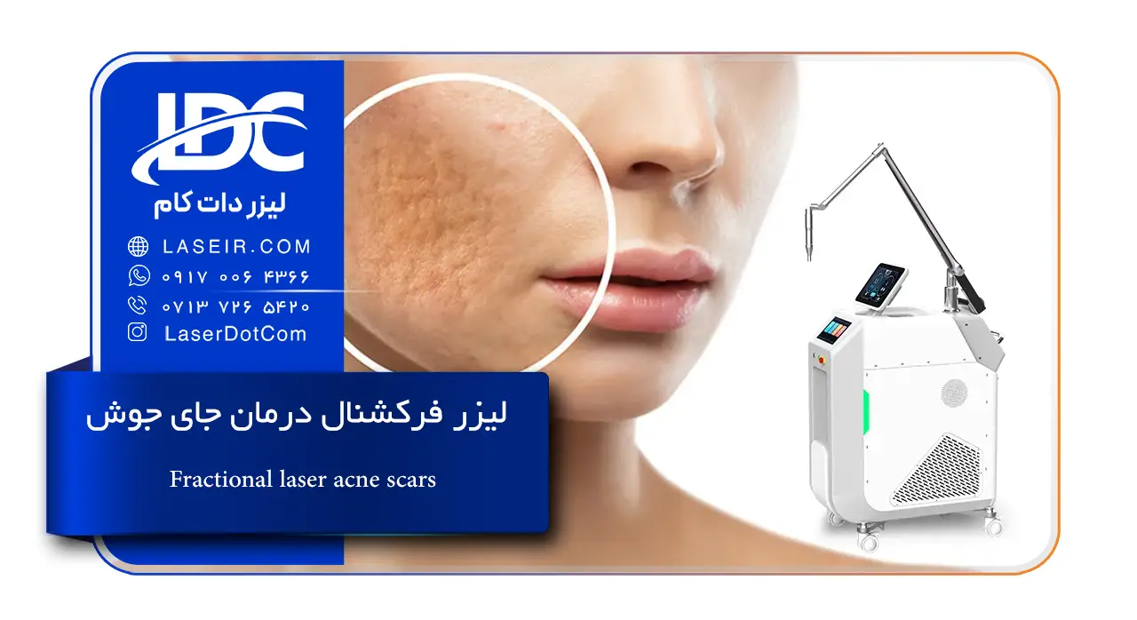 لیزر فرکشنال درمان جای جوش