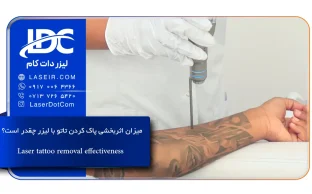 میزان اثربخشی پاک کردن تاتو با لیزر