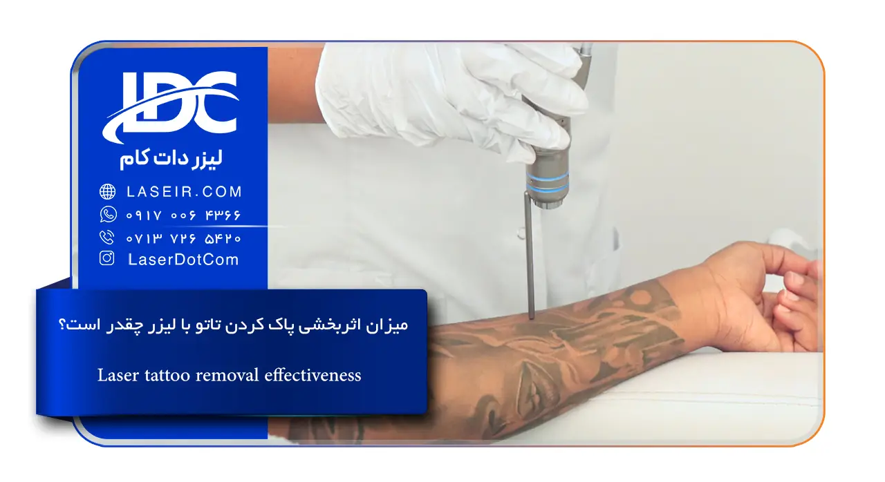 میزان اثربخشی پاک کردن تاتو با لیزر